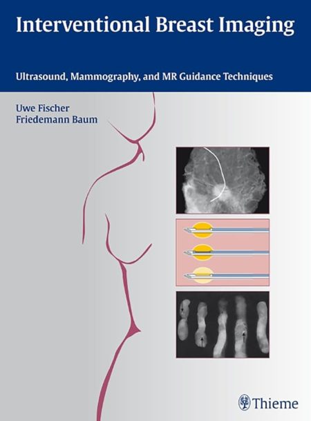 Interventional Breast Imaging. Ultrasound, Mammography, and MR Guidance Techniques