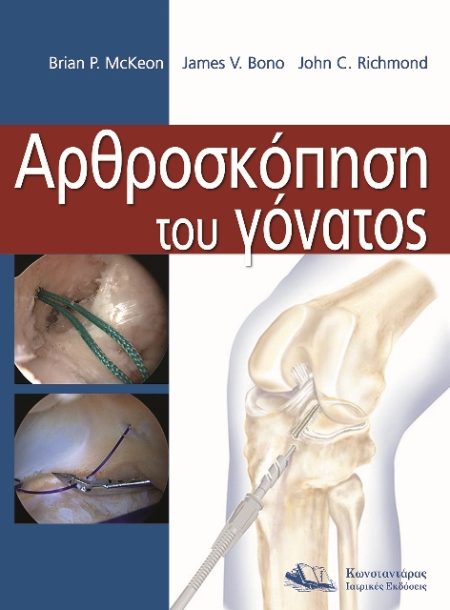 Αρθροσκόπηση του Γόνατος