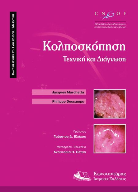 Κολποσκόπηση