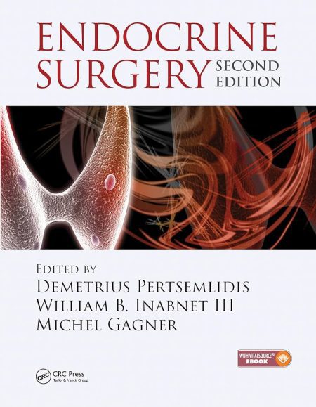 Endocrine Surgery 2nd Edition