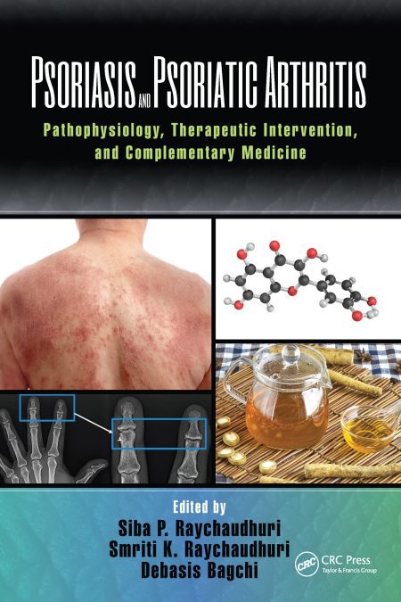 Psoriasis and Psoriatic Arthritis Pathophysiology, Therapeutic Intervention, and Complementary Medicine