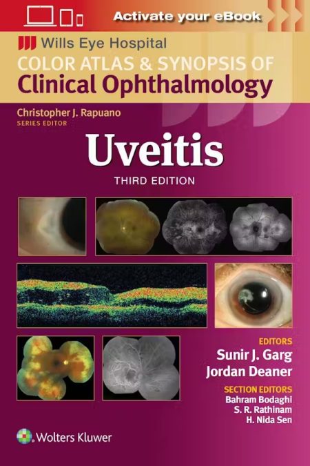 Wills Eye Hospital: Uveitis Third edition