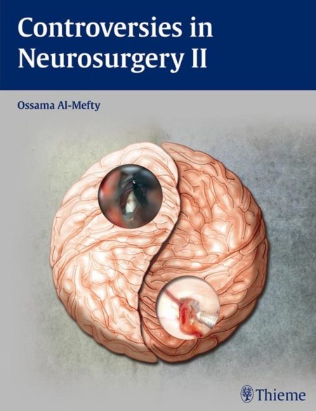 Controversies in Neurosurgery II