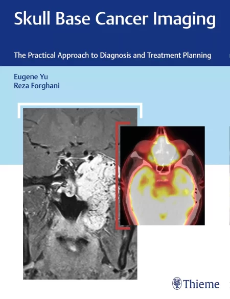Skull Base Cancer Imaging. The Practical Approach to Diagnosis and Treatment Planning