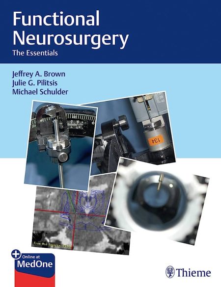 Functional Neurosurgery. The Essentials