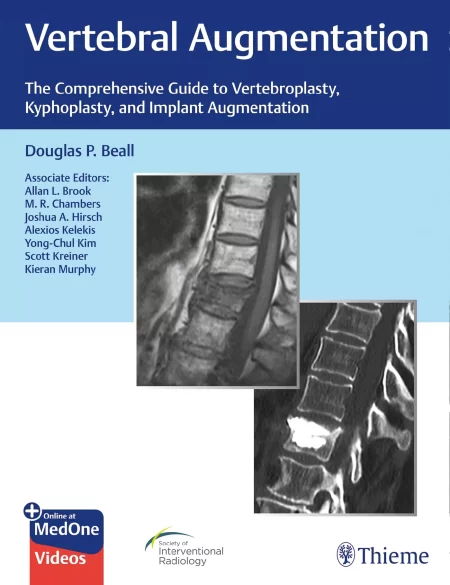 Vertebral Augmentation. The Comprehensive Guide to Vertebroplasty, Kyphoplasty, and Implant Augmentation