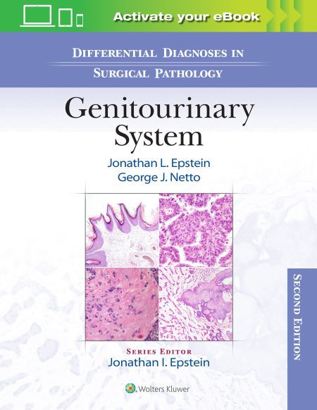 Differential Diagnoses in Surgical Pathology: Genitourinary System Second edition
