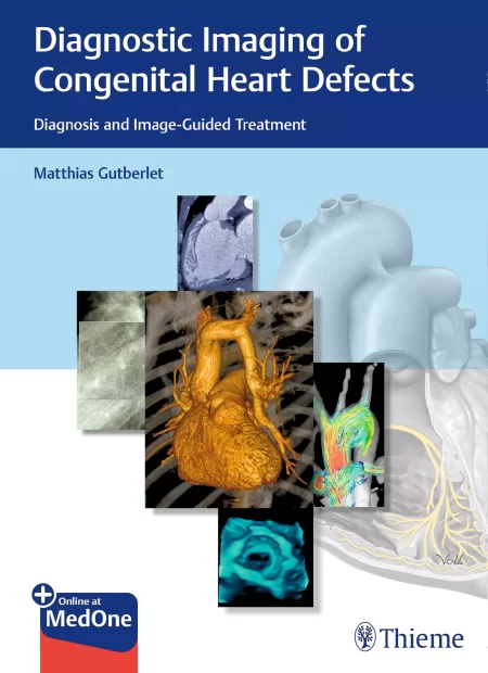 Diagnostic Imaging of Congenital Heart Defects. Diagnosis and Image-Guided Treatment