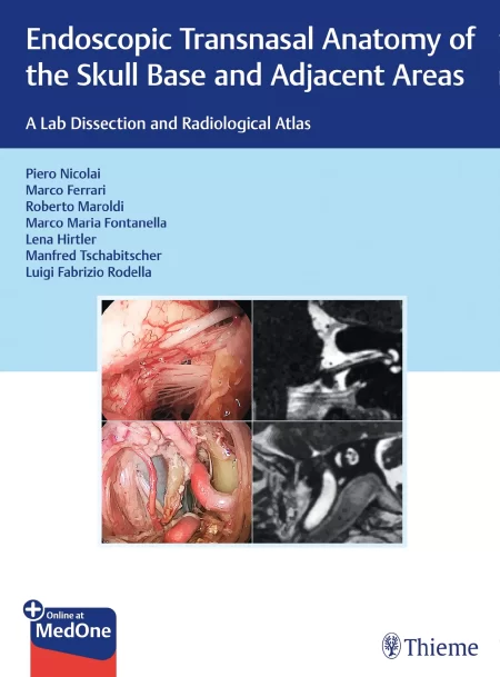 Endoscopic Transnasal Anatomy of the Skull Base and Adjacent Areas. A Lab Dissection and Radiological Atlas