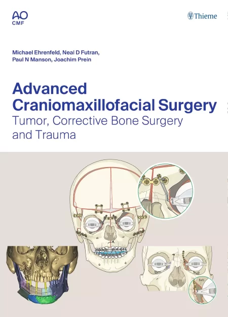 Advanced Craniomaxillofacial Surgery. Tumor, Corrective Bone Surgery, and Trauma