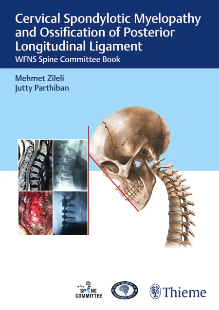 Cervical Spondylotic Myelopathy and Ossification of Posterior Longitudinal Ligament WFNS Spine Committee Book