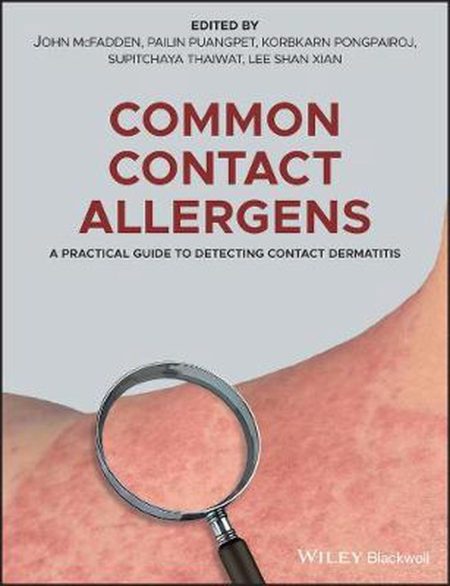 Common Contact Allergens: A Practical Guide to Detecting Contact Dermatitis