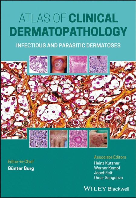 Atlas of Clinical Dermatopathology: Infectious and Parasitic Dermatoses