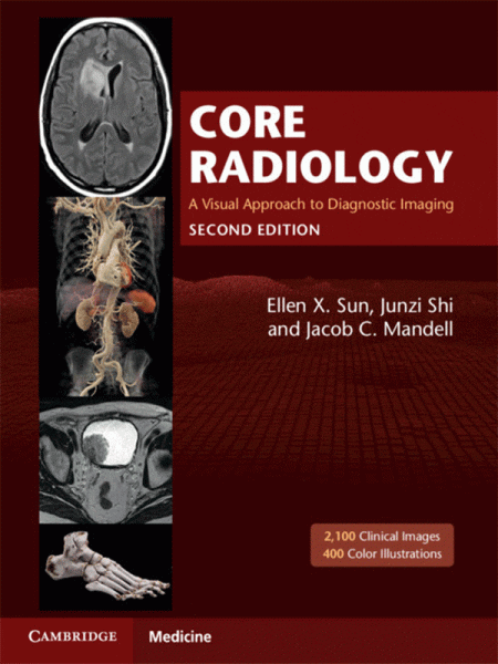 Core Radiology. A Visual Approach to Diagnostic Imaging 2nd Edition 2 volume set