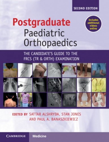 Postgraduate Paediatric Orthopaedics. The Candidate's Guide to the FRCS (Tr&Orth) Examination 2nd Edition