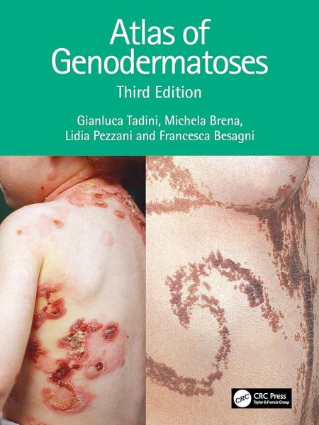 Atlas of Genodermatoses 3rd Edition