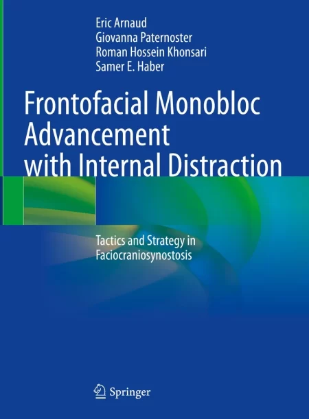 Frontofacial Monobloc Advancement with Internal Distraction. Tactics and Strategy in Faciocraniosynostosis