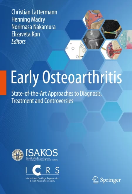 Early Osteoarthritis. State-of-the-Art Approaches to Diagnosis, Treatment and Controversies