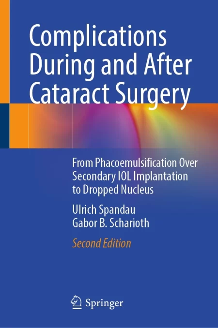 Complications During and After Cataract Surgery. From Phacoemulsification Over Secondary IOL Implantation to Dropped Nucleus
