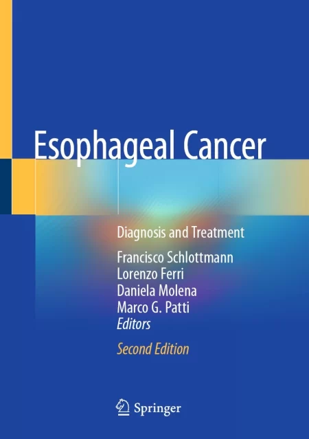 Esophageal Cancer. Diagnosis and Treatment