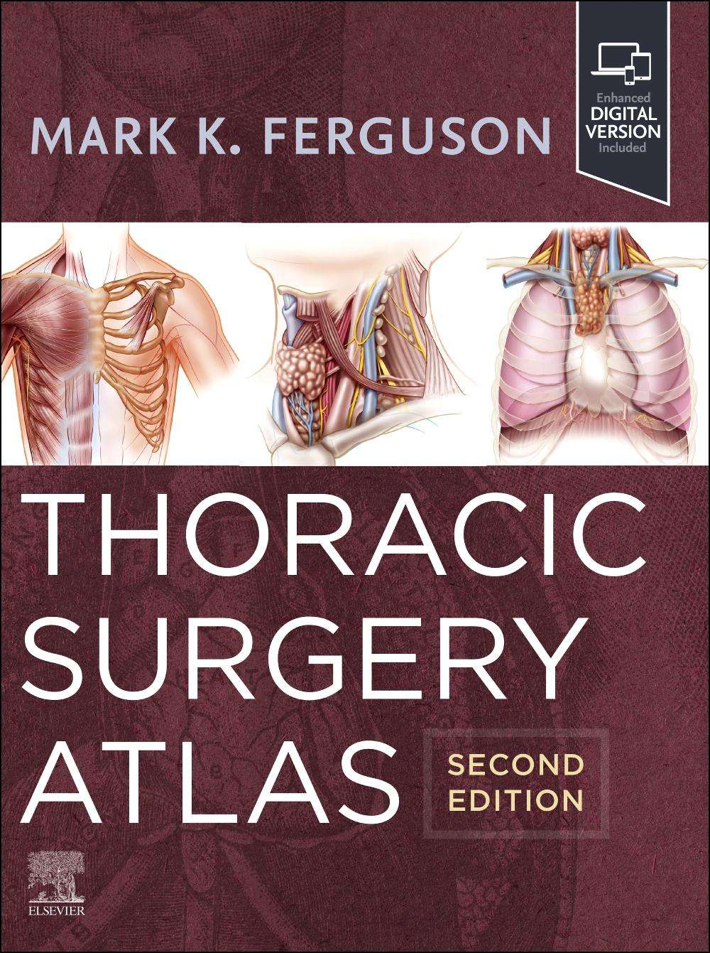 Thoracic Surgery Atlas, 2nd Edition | Εκδόσεις Κωνσταντάρας