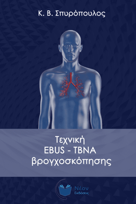 Τεχνική EBUS-TBNA βρογχοσκόπησης
