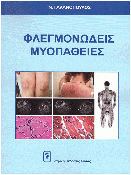 Φλεγμονώδεις Μυοπάθειες