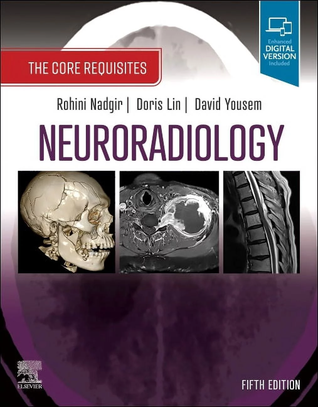 Neuroradiology, 5th Edition. The Core Requisites
