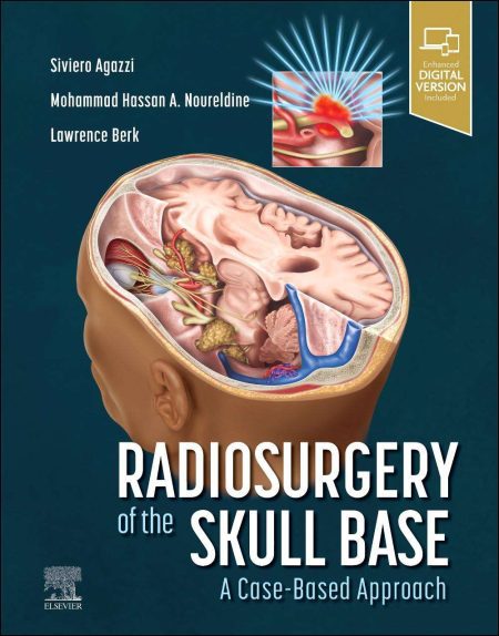 Radiosurgery of the Skull Base: A Case-Based Approach, 1st Edition