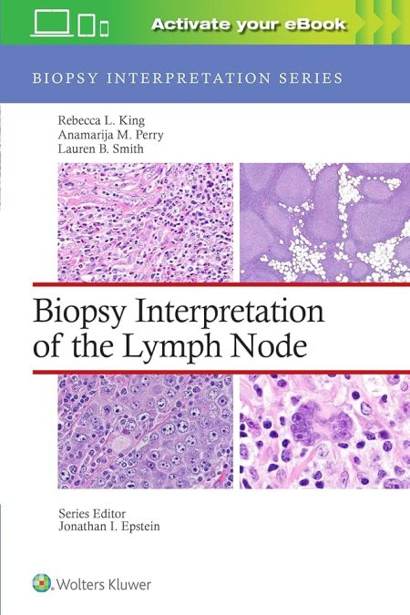 Biopsy Interpretation of the Lymph Node: Print + eBook with Multimedia First edition