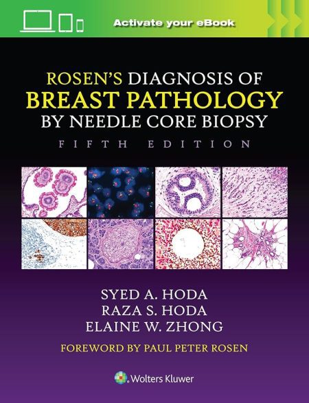 Rosen's Diagnosis of Breast Pathology by Needle Core Biopsy Fifth edition