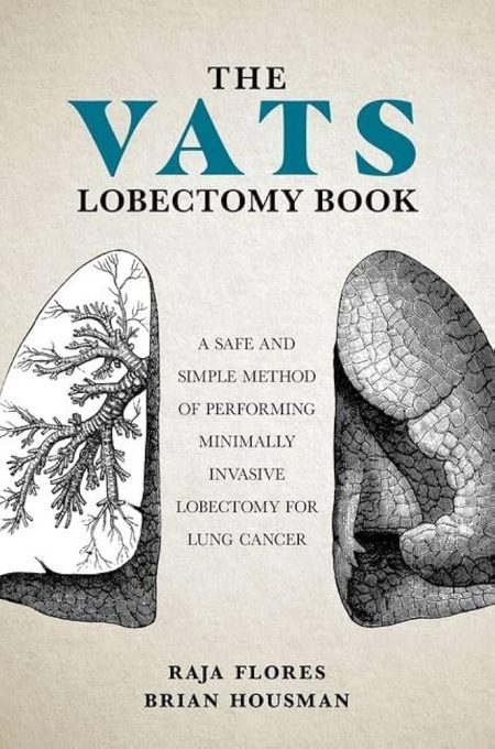 The VATS Lobectomy Book. A Safe and Simple Method of Performing Minimally Invasive Lobectomy for Lung Cancer