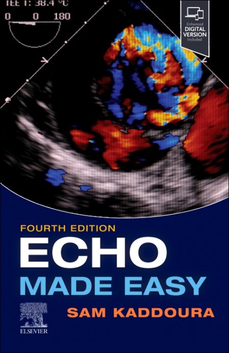 Echo Made Easy, 4th Edition