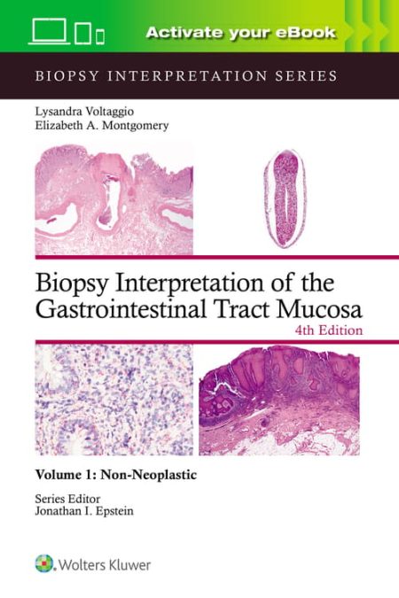 Biopsy Interpretation of the Gastrointestinal Tract Mucosa Volume 1. Non-Neoplastic: Print + eBook with Multimedia, Fourth edition