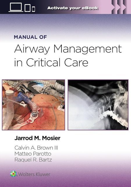 Manual of Airway Management in Critical Care: Print + eBook with Multimedia First edition