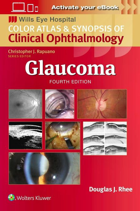 Wills Eye Hospital: Glaucoma Fourth edition