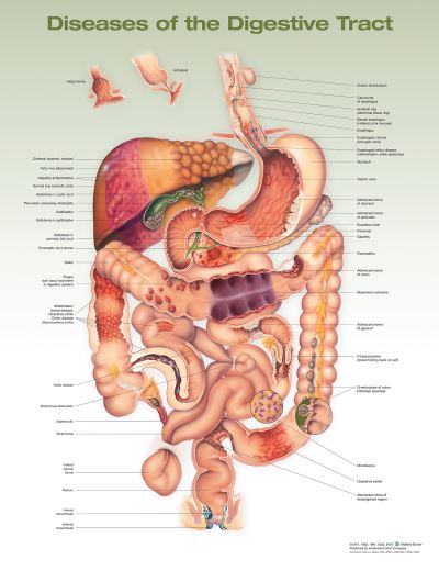 Diseases of the Digestive Tract Anatomical Chart Second edition