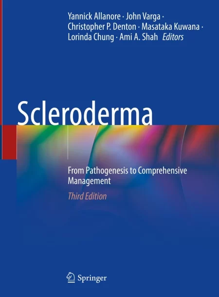 Scleroderma. From Pathogenesis to Comprehensive Management