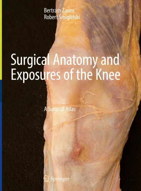 Surgical Anatomy and Exposures of the Knee. A Surgical Atlas