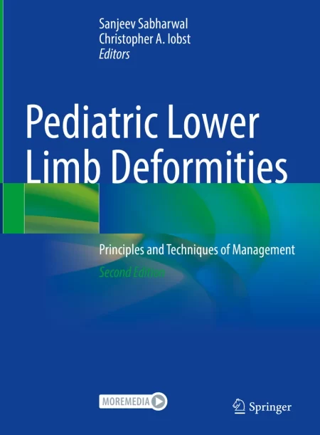 Pediatric Lower Limb Deformities. Principles and Techniques of Management