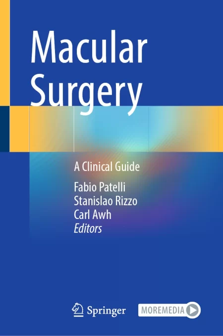 Macular Surgery. A Clinical Guide