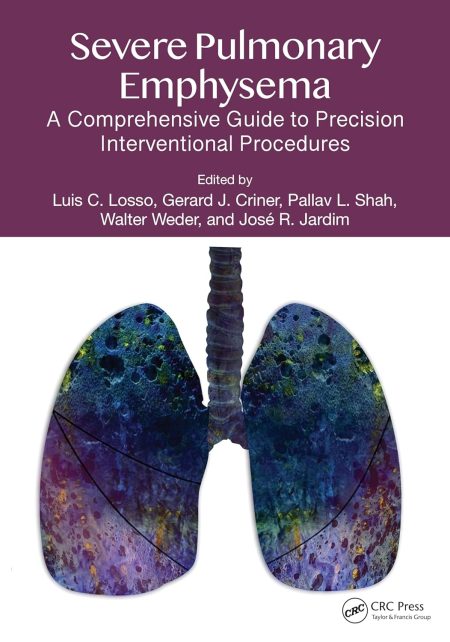 Severe Pulmonary Emphysema: A Comprehensive Guide to Precision Interventional Procedures
