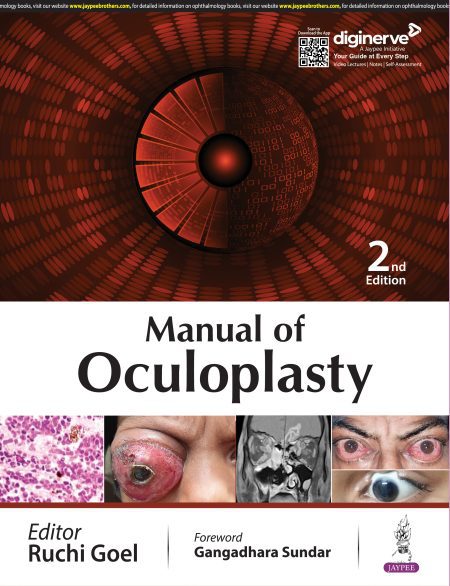 Manual of Oculoplasty 2/e