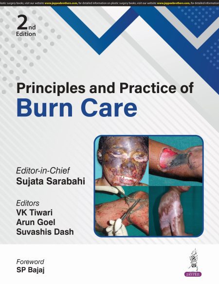 Principles and Practice of Burn Care 2/e