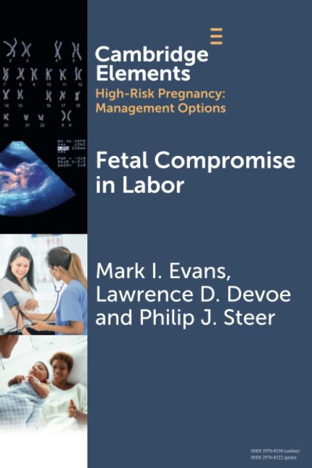 Fetal Compromise in Labor
