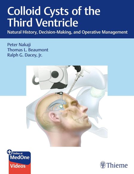Colloid Cysts of the Third Ventricle. Natural History, Decision-Making, and Operative Management