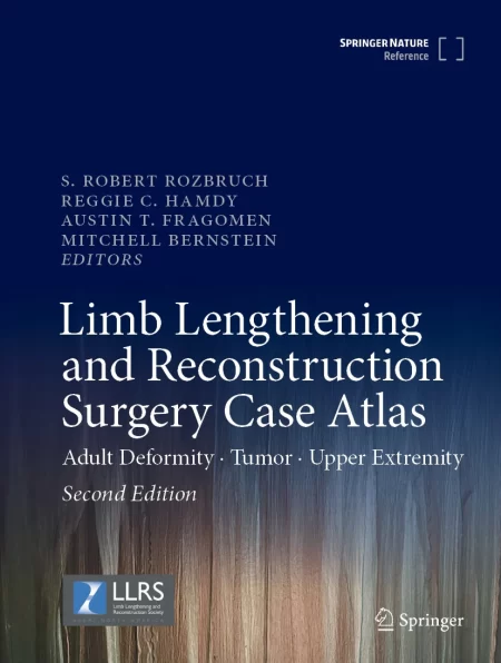 Limb Lengthening and Reconstruction Surgery Case Atlas. Adult Deformity • Tumor • Upper Extremity