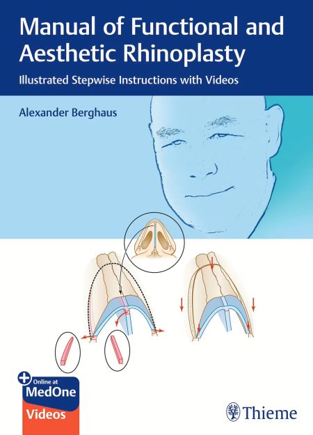 Manual of Functional and Aesthetic Rhinoplasty. Illustrated Stepwise Instructions with Videos