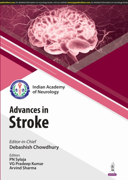IAN Advances in Stroke
