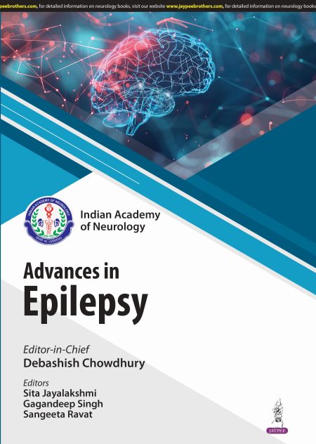 Advances in Epilepsy